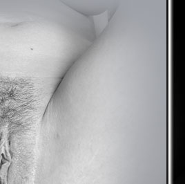 Anal Path